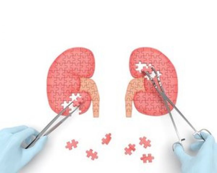 nefropatie-diabetica.jpg